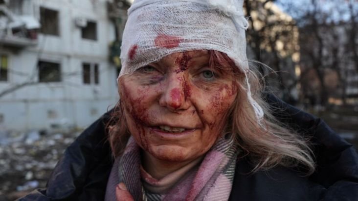 Na fotografia há uma mulher com a cabeça enfaixada e sangue pelo rosto. Ela usa casaco preto e cachecol rosa - Metrópoles
