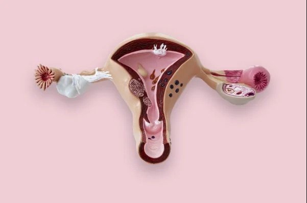 One uterus depicting a lesion of cervical cancer-Metropole