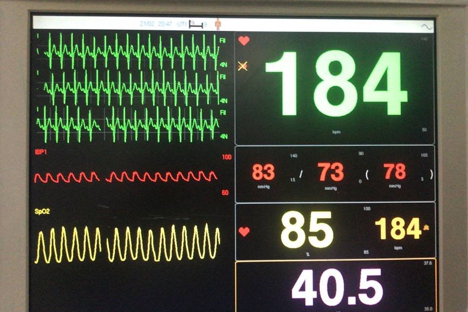 Monitor de sinais vitais