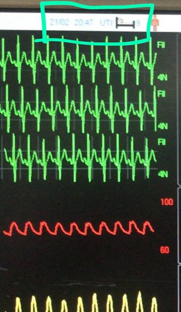 Monitor de sinais vitais