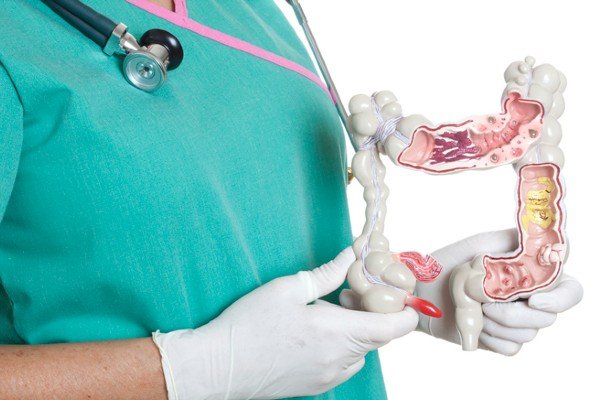 A man dressed in a hospital uniform holds an object representing intestines - Metropolis