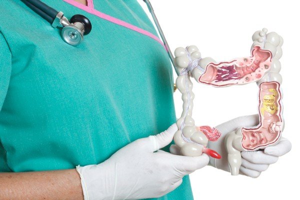 Person dressed in hospital uniform holds object representing the intestine - Metropolises