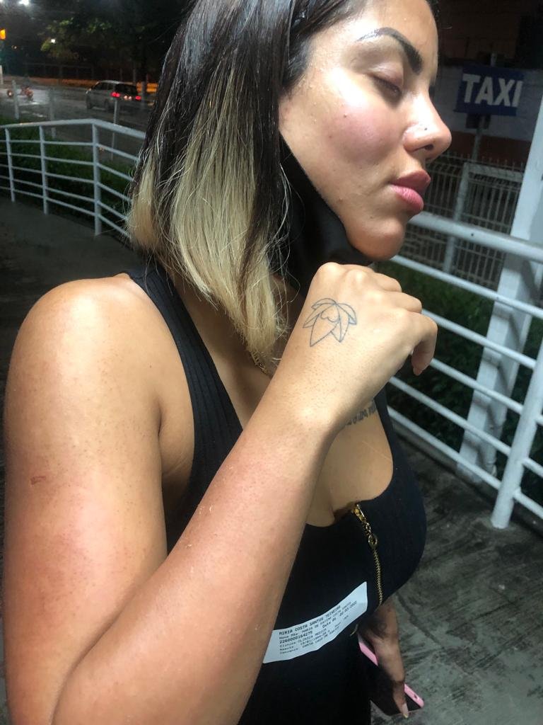 A esteticista Miria Teixeira diz que foi agredida por filho de ex-companheiro em velório no Guarujá