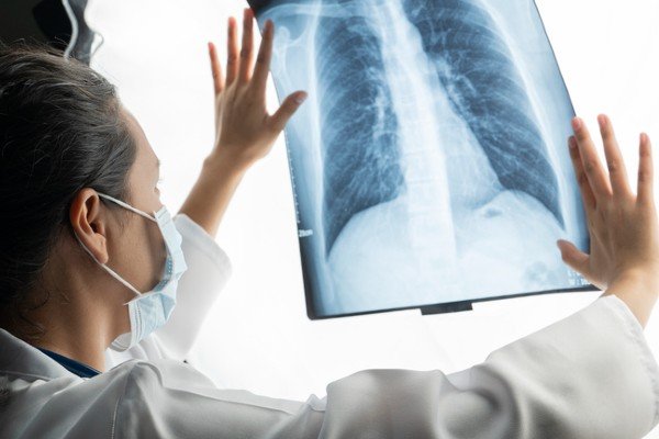 Imagem mostra médica analisando raio x de pulmão-Metrópoles