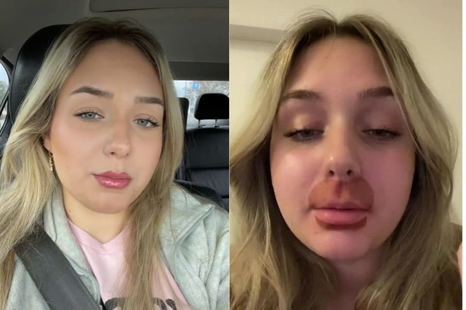 antes e depois de menina