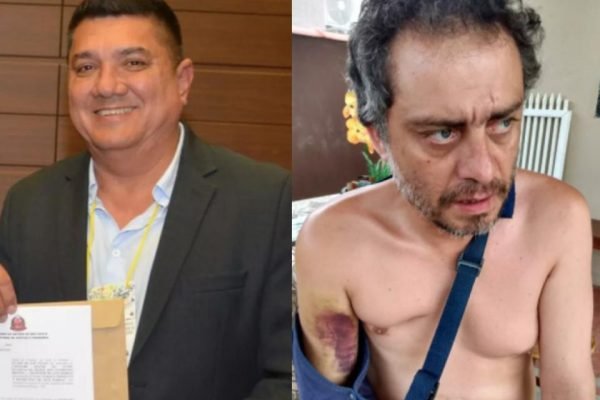 Prefeito Dean Alves Martins e o morador agredido Enio Lorena de Souza Junior