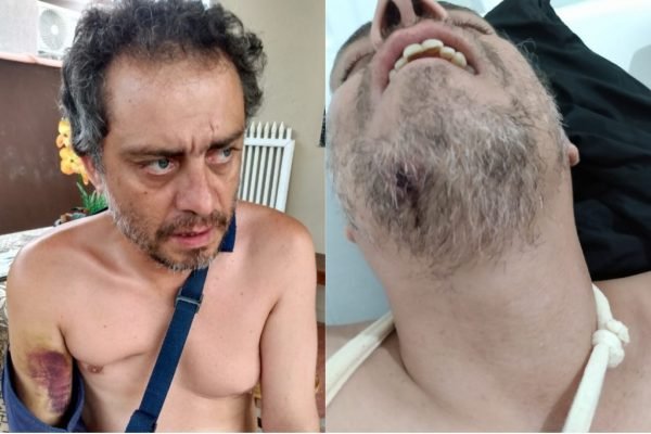 O servidor Enio Lorena de Souza Junior foi agredido com 