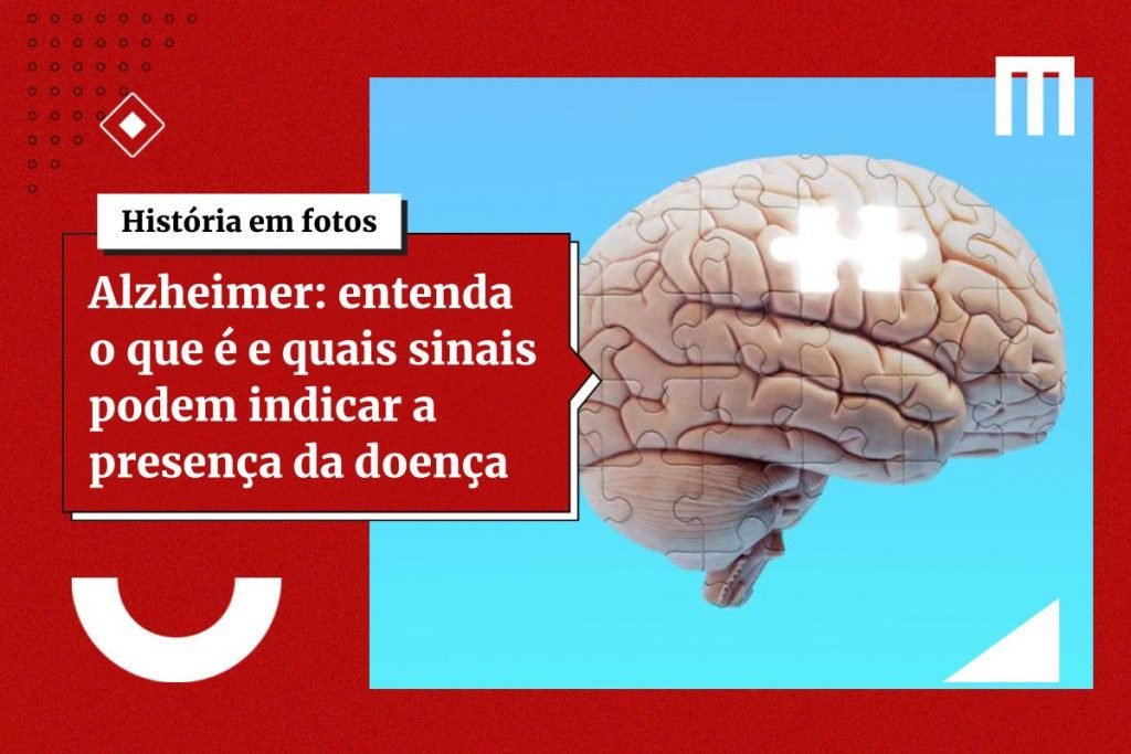 Veja 5 hábitos que ajudam a prevenir o Alzheimer, segundo a