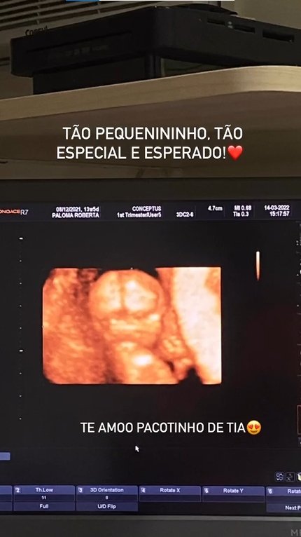 Grávida de três meses, MC Loma compartilhou imagens de sua última ultrassonografia
