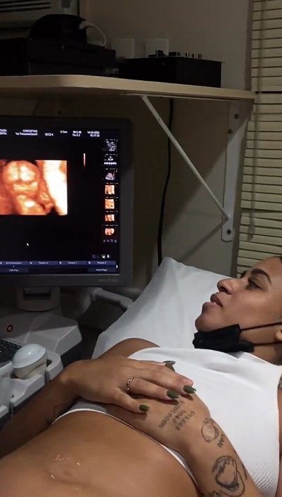 Grávida de três meses, MC Loma compartilhou imagens de sua última ultrassonografia