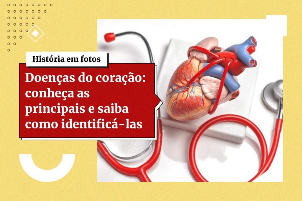 Conheça 6 sinais que o corpo dá antes do infarto 