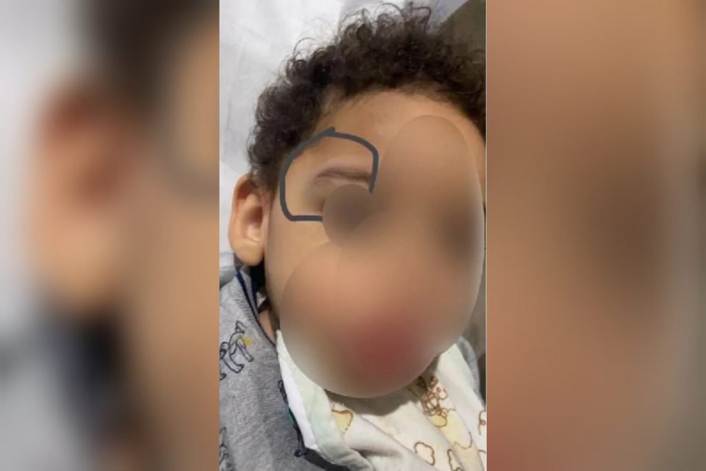 Mother reports son injured at school