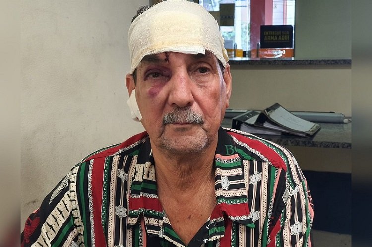 Motorista de ônibus Luiz Carlos Ribeiro,69, agredido 2