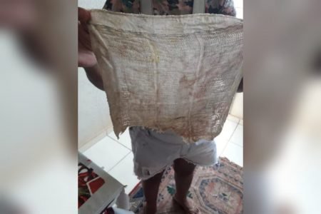 Franciele Cristina da Silva, 35 anos, descobriu na sexta-feira passada (11/3), que estava tendo febre e dores porque um pano teria sido deixado em seu ânus durante cesárea