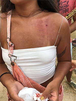 Rio: foliã leva tiro de chumbinho durante ensaio de bloco de rua