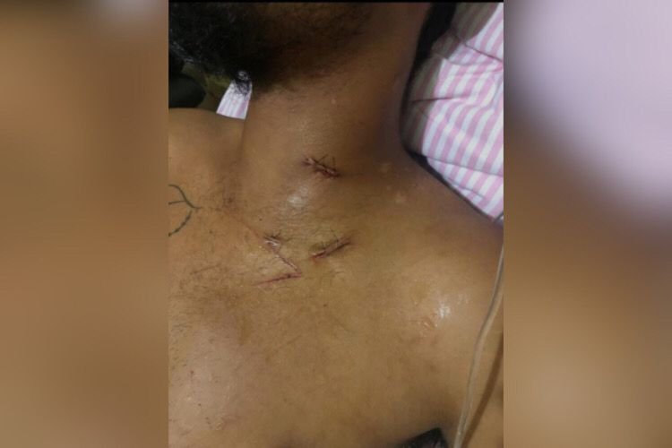 homem persegue esfaqueia amigo itumbiara goias (2)