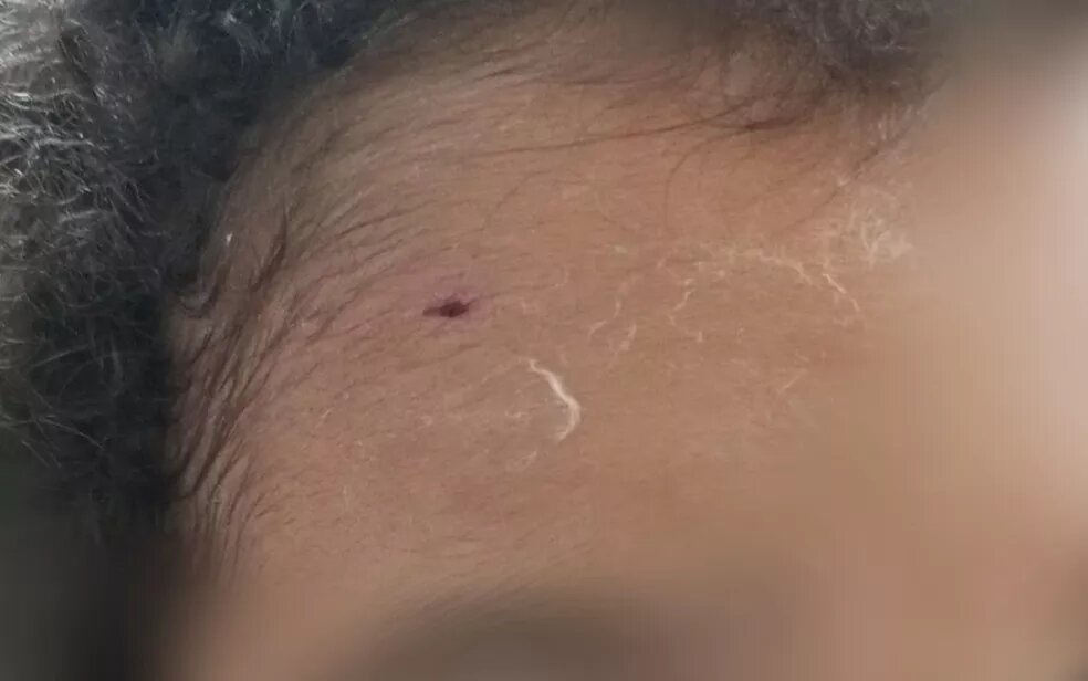 Janailma Pergentino de Oliveira Santos, 35 anos, e o filho João Pedro Pergentino Santos, de 6 anos, foram atacados por um pit-bull