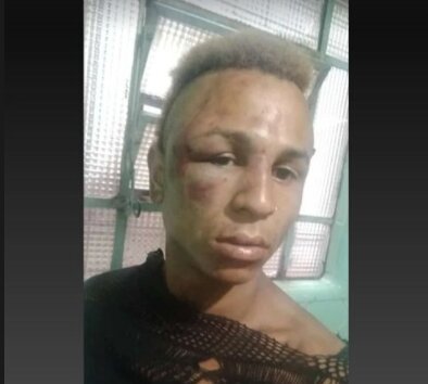 Fernanda Frazão estava em uma rua no centro de São Paulo na madrugada desta segunda-feira (28/3) quando começou a ser agredida