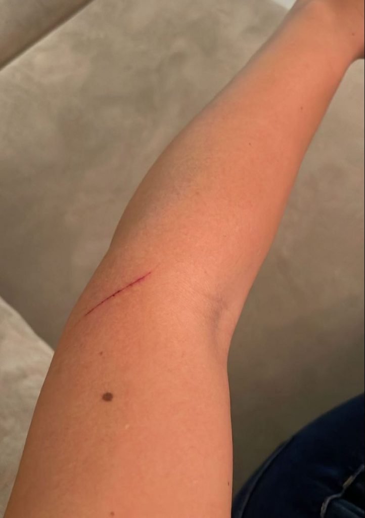 Bruna Maciel, esposa do jogador Fernandinho, do Brusque, denuncia agressão em estádio