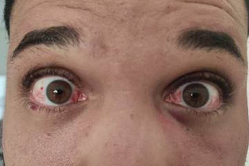 Motorista de app é agredido por PMs em Santa Maria
