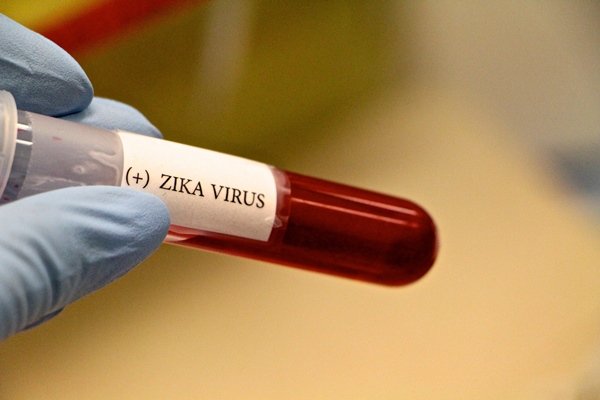 Mão com luva azul segurando recipiente com etiqueta de zika virus e com líquido vermelho - Metrópoles