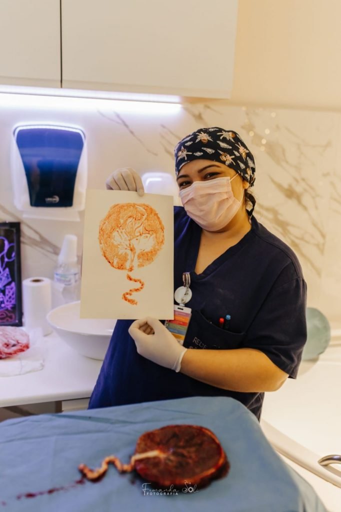 fotografia colorida de enfermeira obstetra com placenta e arte