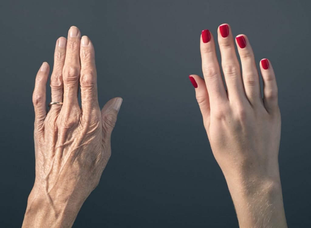 Cientistas conseguem rejuvenescer pele de mulher em 30 anos