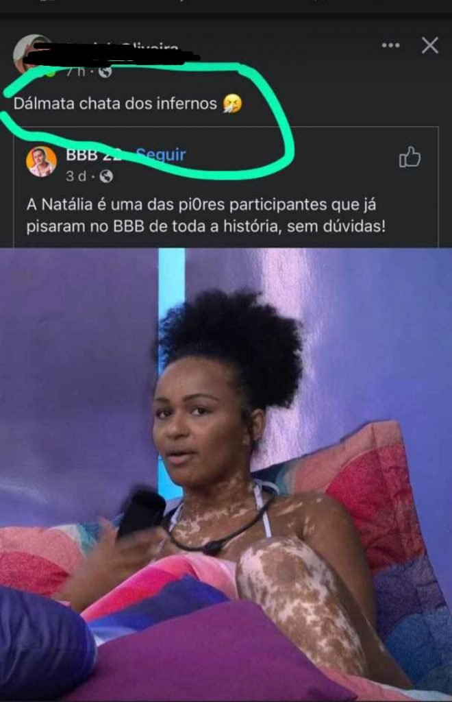 Pessoa faz comentário preconceituoso sobre vitiligo da participante Natália, do BBB22 - Metrópoles