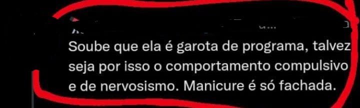 BBB22: Natália é alvo de ataques preconceituosos por conta de vitiligo