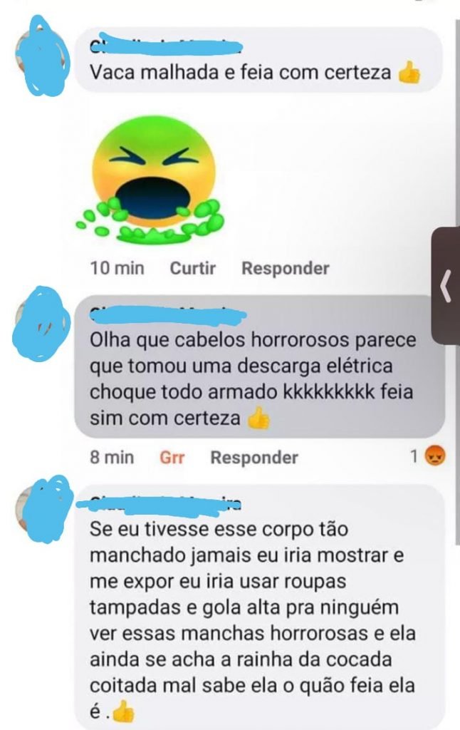 Pessoas fazem comentário preconceituoso sobre vitiligo da participante Natália, do BBB22 - Metrópoles