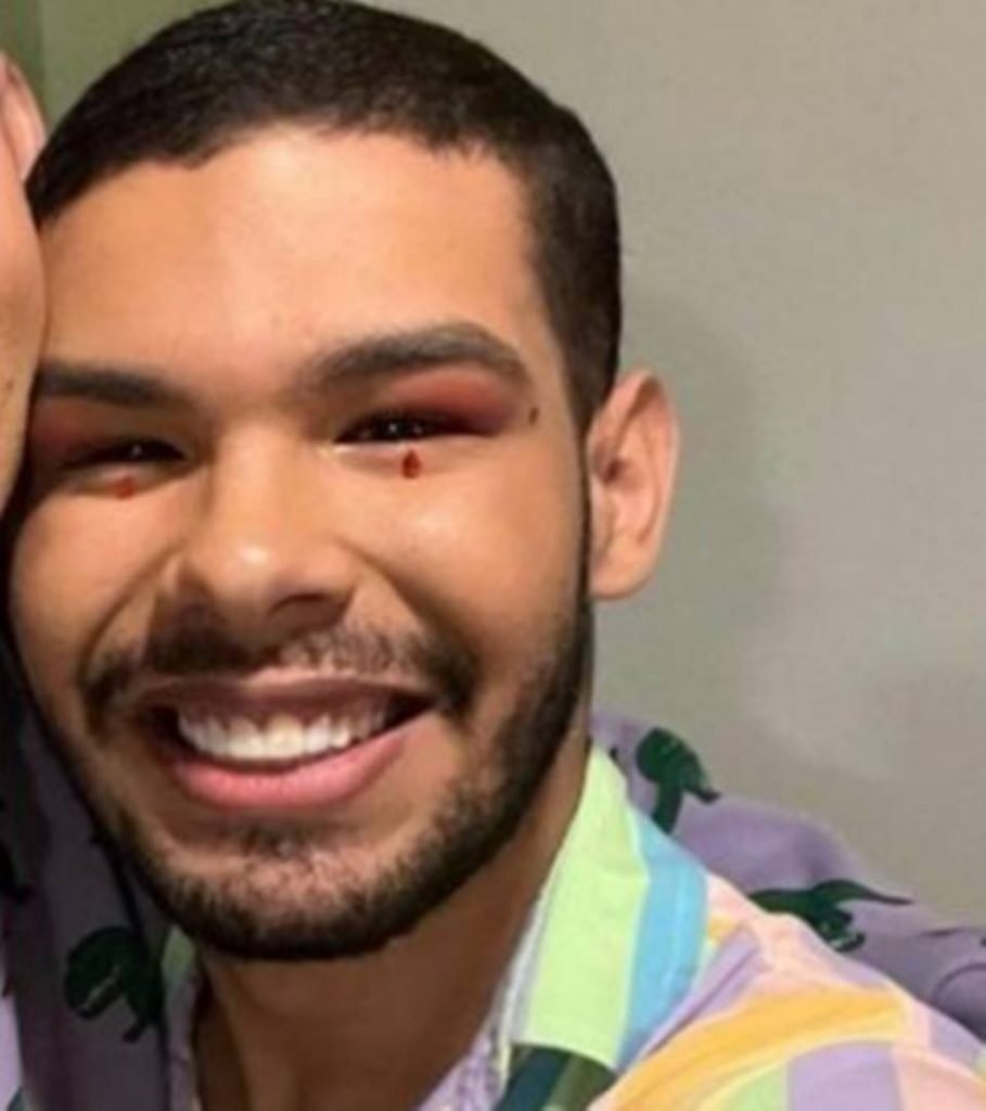 Vyni depois de colocar prótese nos dentes