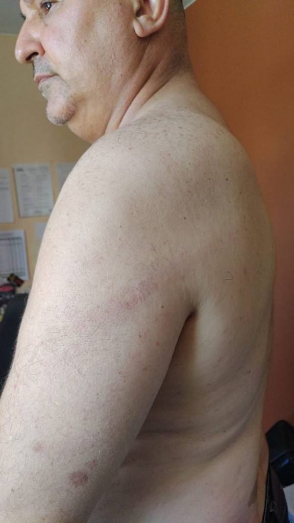 Marcas da agressão ao síndico