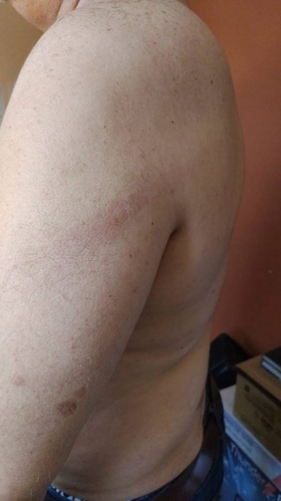 Marcas da agressão ao síndico