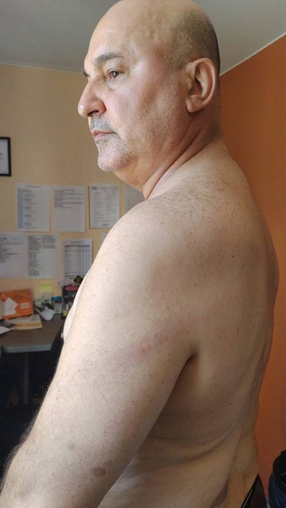 Marcas da agressão ao síndico