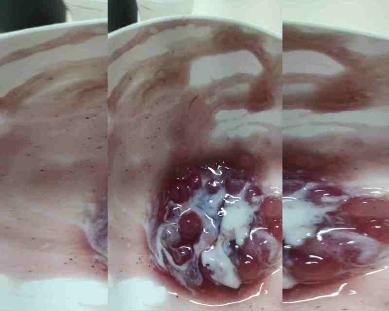 Pelo é encontrado em sobremesa servida no Hospital de Base - Metrópoles