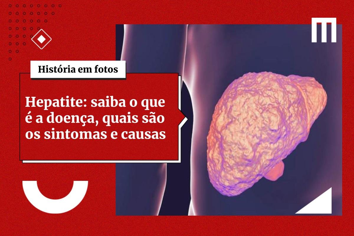 Hepatite Saiba O Que A Doen A Quais S O Os Sintomas E As Causas