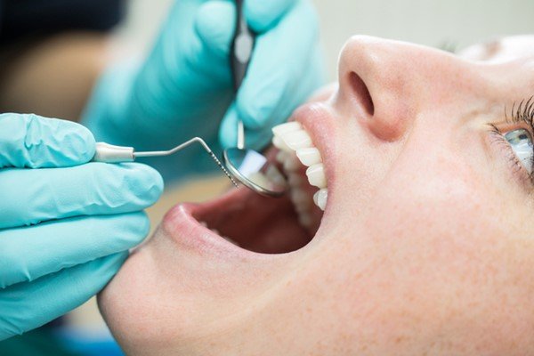 Pessoa com a boca aberta realizando procedimento dentário - Metrópoles