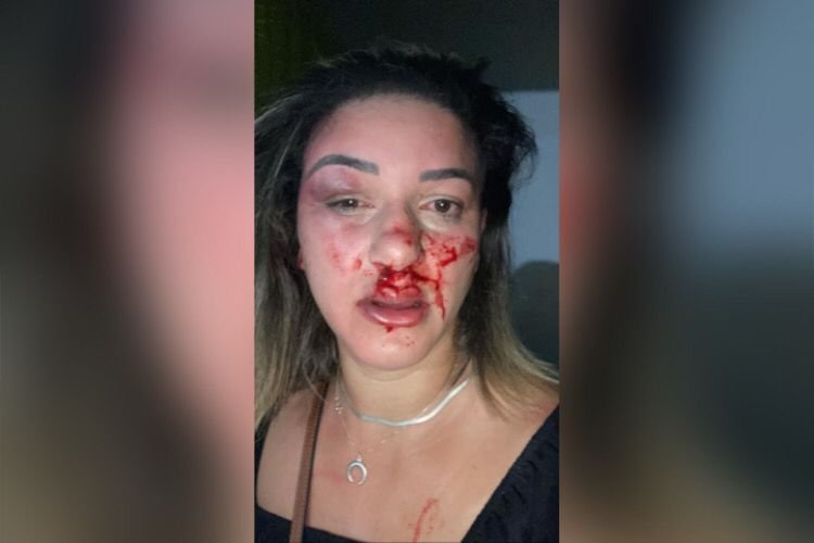 ive dourado mulher espancada ex marido rio de janeiro (2)