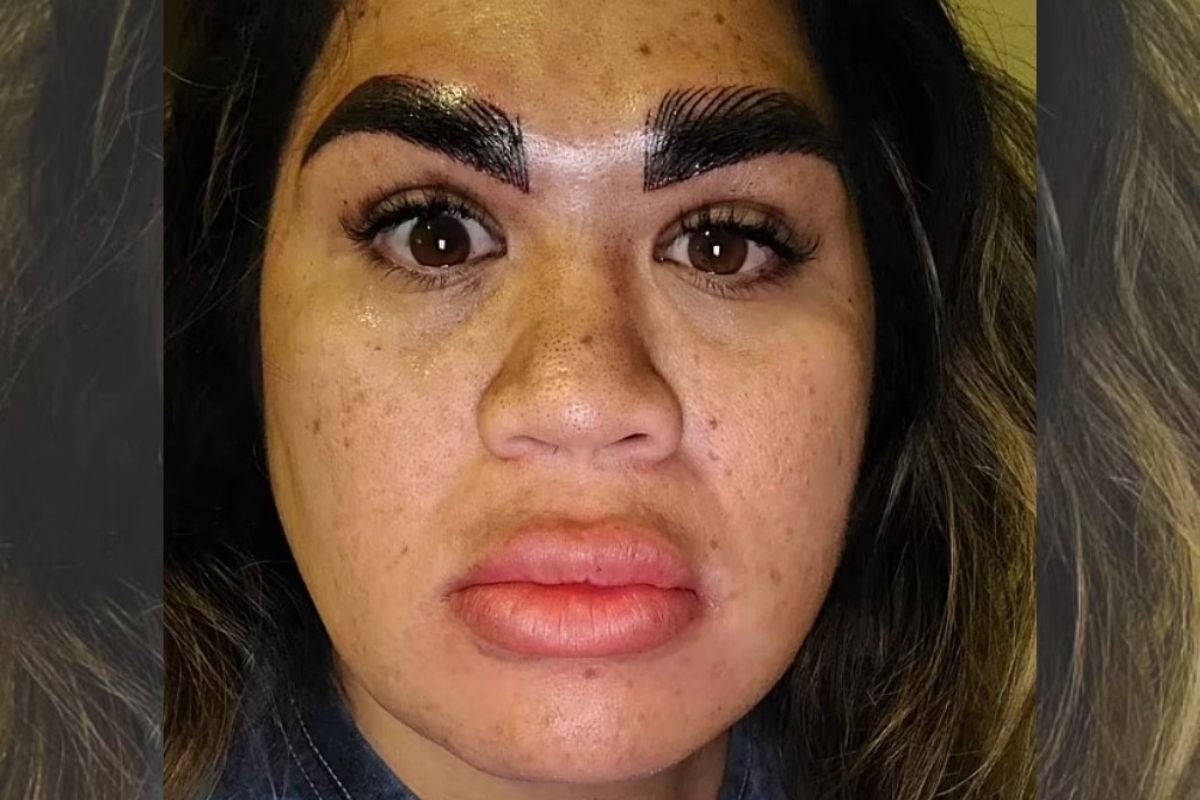 The procedure goes wrong and leaves the woman with creepy eyebrows