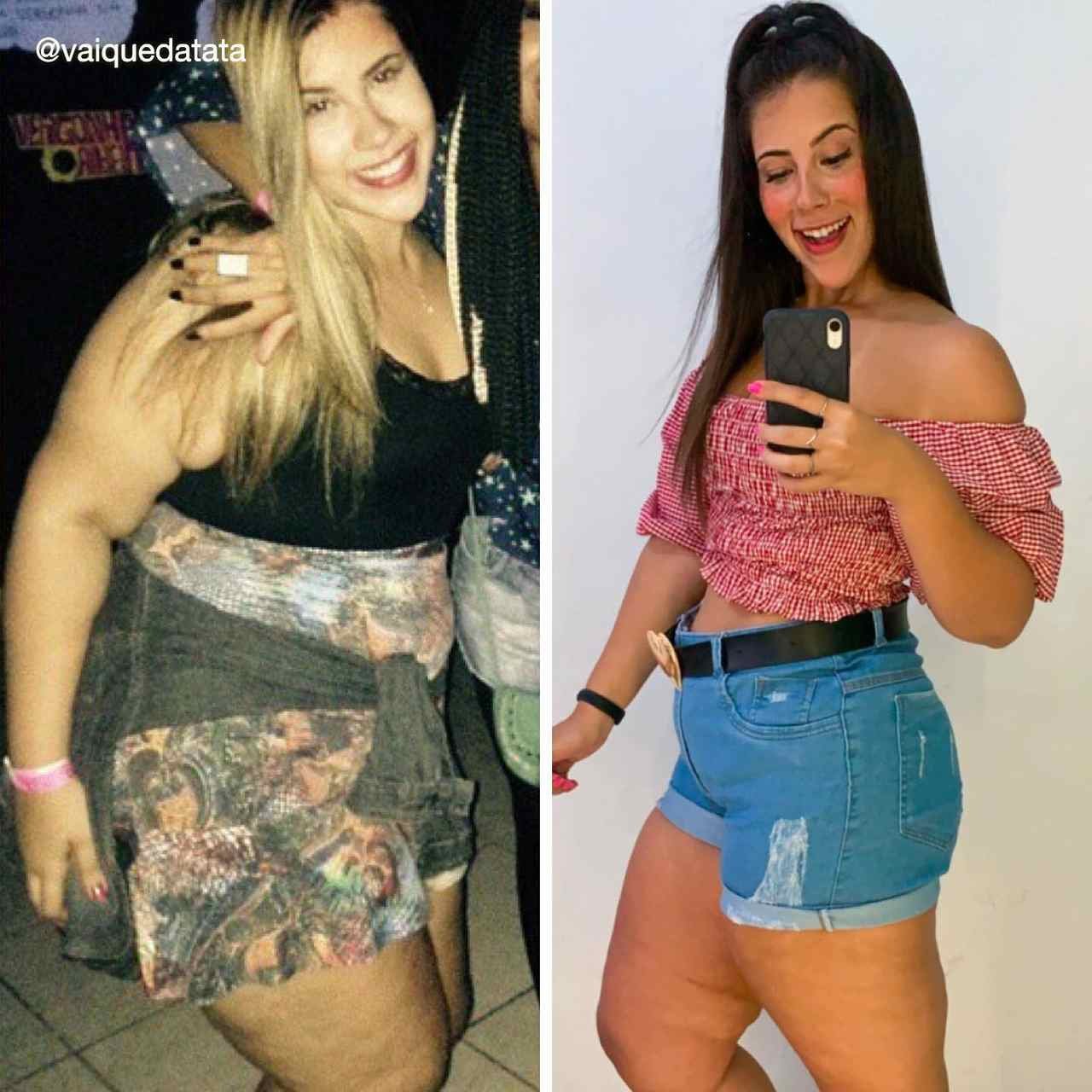 Ex-obesa, carioca compartilha como perdeu 50 quilos sem cirurgia