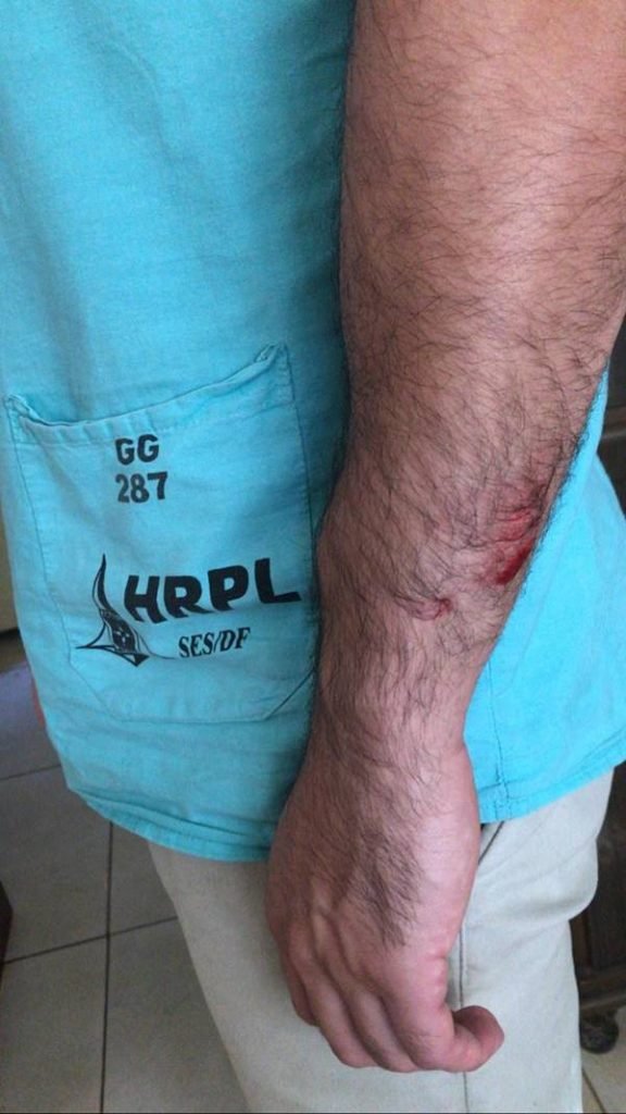Profissional com braço ferido após agressão
