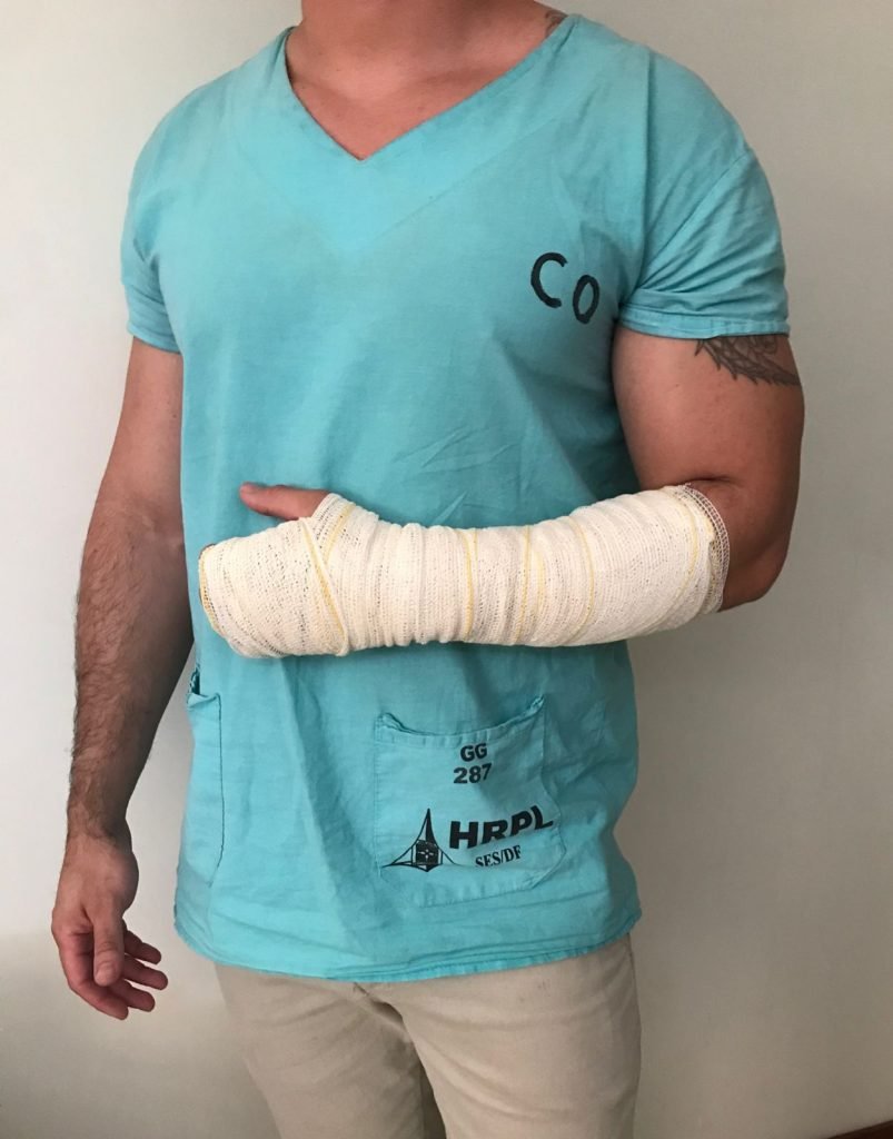 homem com braço engessado