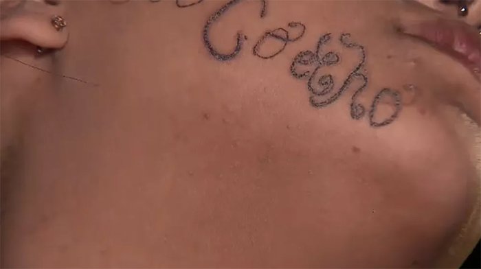 Ex-namorado tatua nome no rosto de adolescente em SP