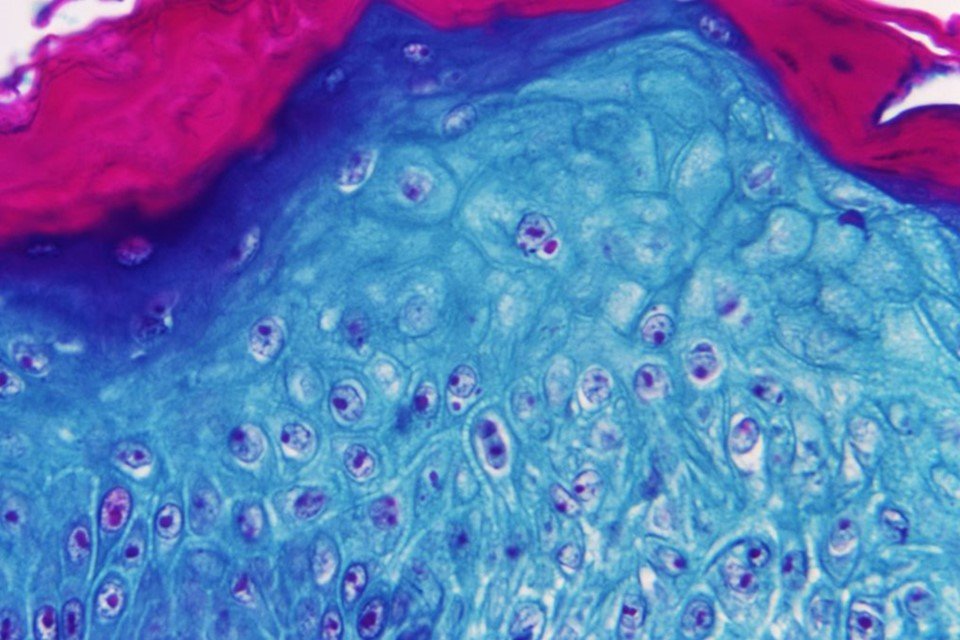 Imagem de vírus em microscópio. Imagem azul com rosa