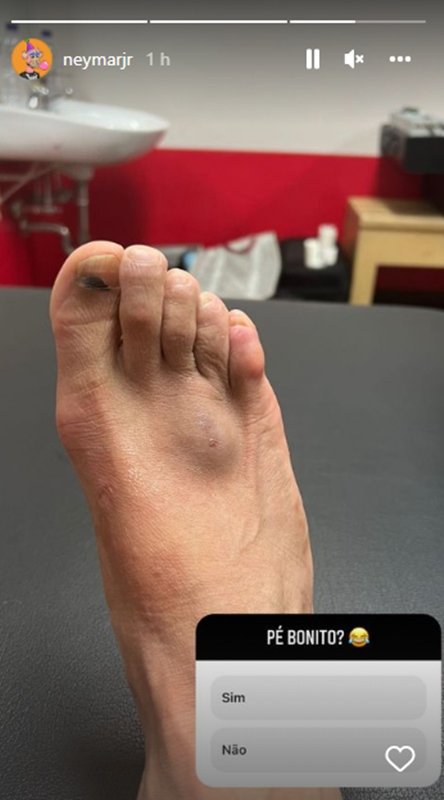 Neymar publica foto do pé machucado no Instagram