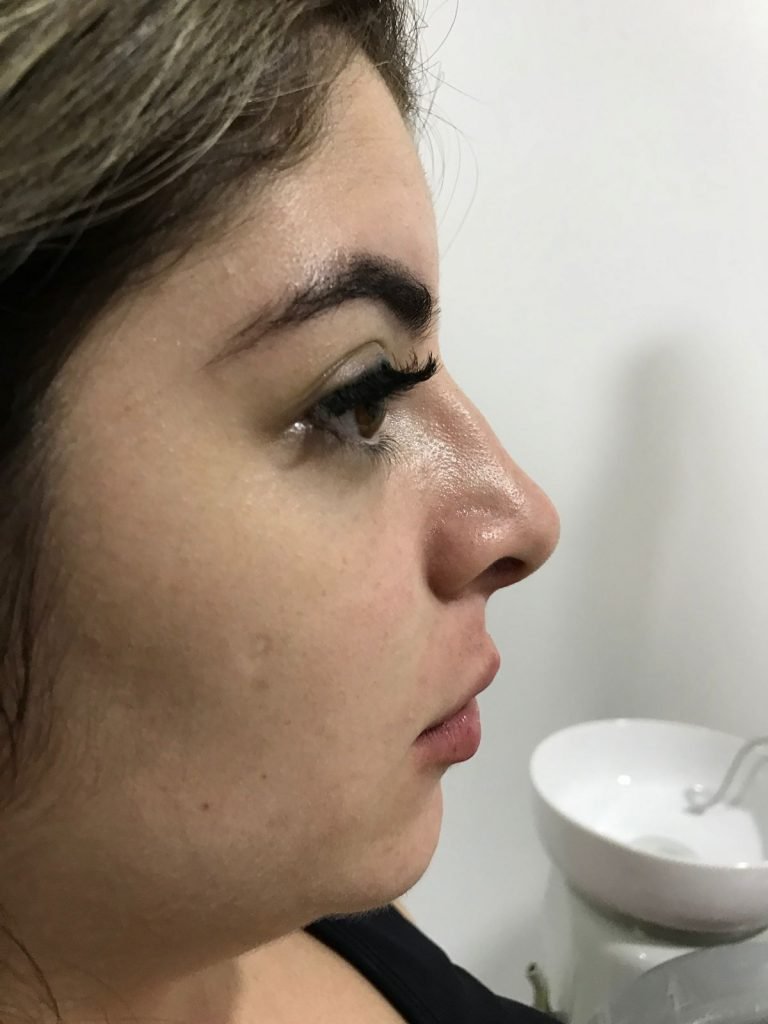 Gkay já fez harmonização facial, aplicou botox, rinoplastia e preenchimentos