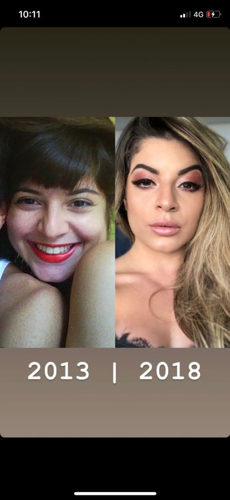 Antes e depois de Géssica
