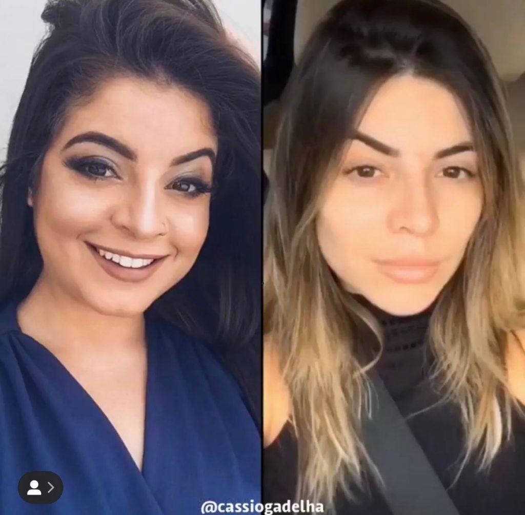 Antes e depois de Géssica
