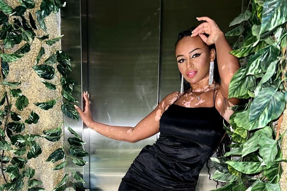 Natália Deodato, em foto para o Instagram - Metrópoles