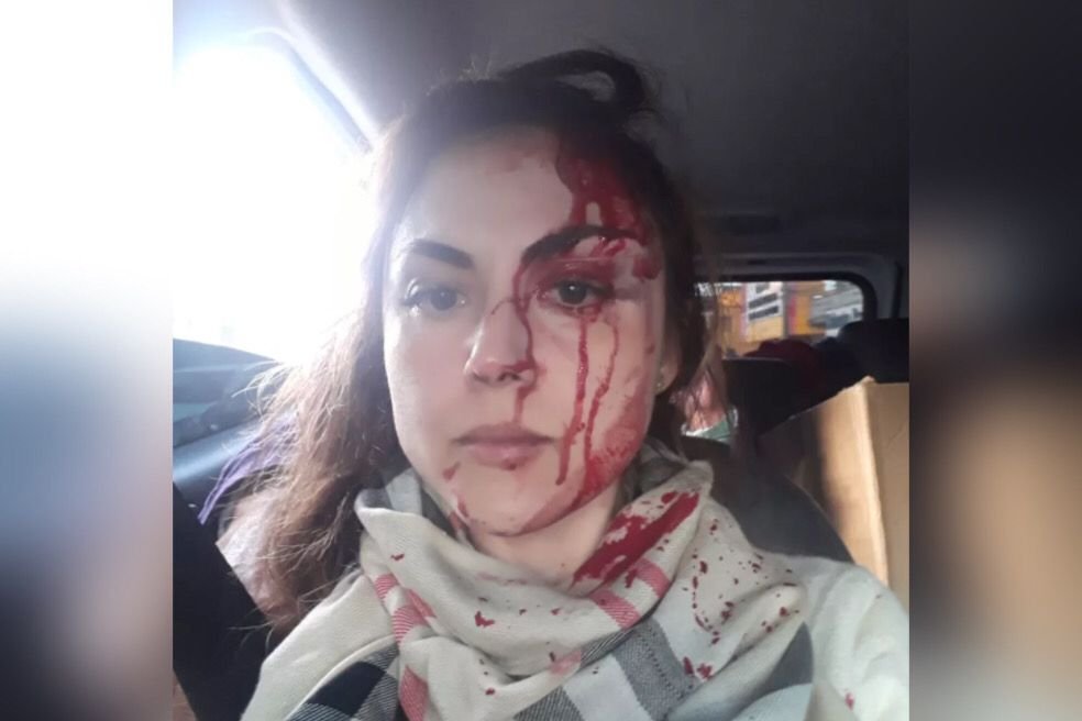 Vídeo: procuradora é agredida com brutalidade por colega em SP